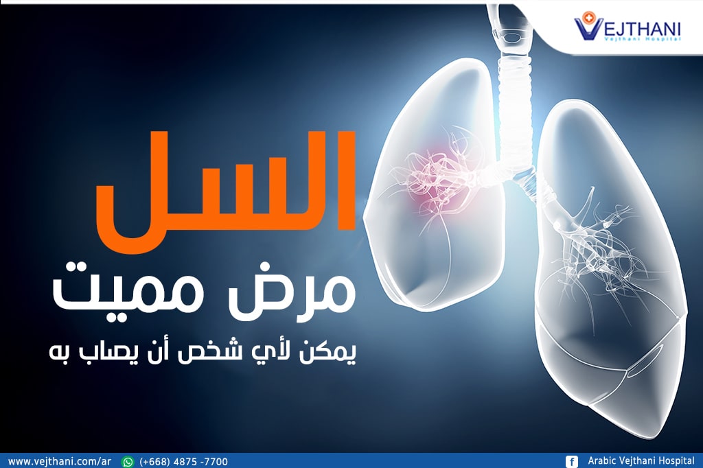 صورة المقال